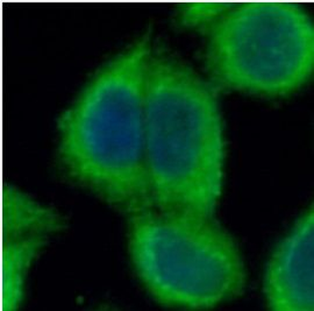 CLPP Rabbit Polyclonal Antibody