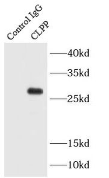 CLPP Rabbit Polyclonal Antibody