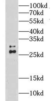 CLPP Rabbit Polyclonal Antibody