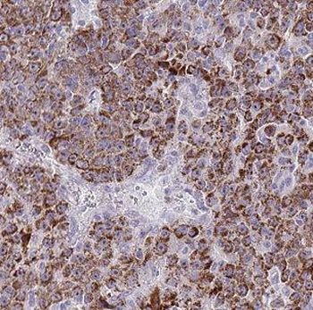 CLPP Rabbit Polyclonal Antibody
