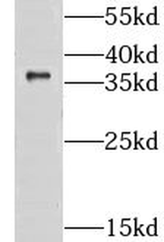CLYBL Rabbit Polyclonal Antibody