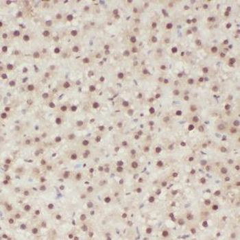 CLYBL Rabbit Polyclonal Antibody