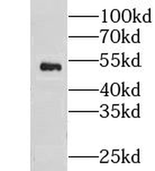 CNDP2 Rabbit Polyclonal Antibody