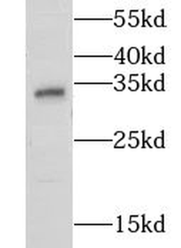 CNN2 Rabbit Polyclonal Antibody