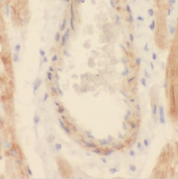 CNN2 Rabbit Polyclonal Antibody