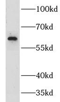 CNOT2 Rabbit Polyclonal Antibody