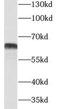CNOT4 Rabbit Polyclonal Antibody
