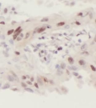 CNOT4 Rabbit Polyclonal Antibody