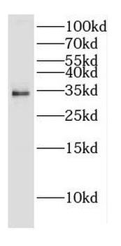 CNOT7 Antibody
