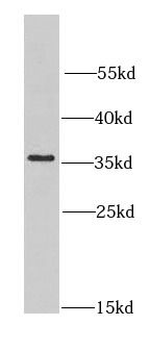 CNOT8 Antibody