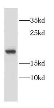 CNRIP1 Rabbit Polyclonal Antibody