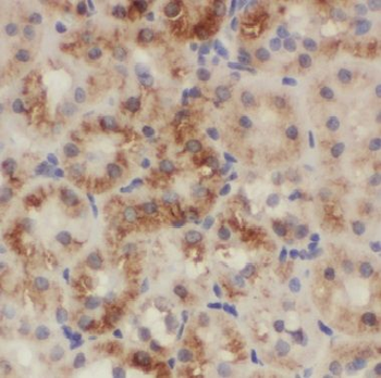 CNRIP1 Rabbit Polyclonal Antibody