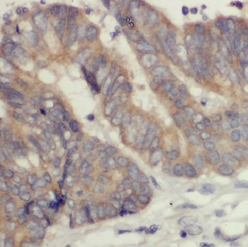 COASY Rabbit Polyclonal Antibody