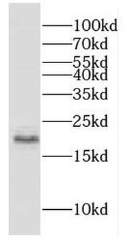 CFL2 Rabbit Polyclonal Antibody