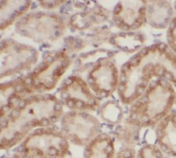 Collagen Type IV Rabbit Polyclonal Antibody
