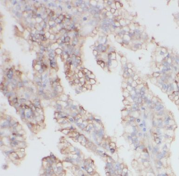 COL6A2 Antibody