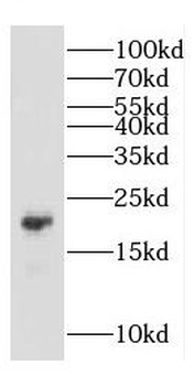 COMMD1 Rabbit Polyclonal Antibody