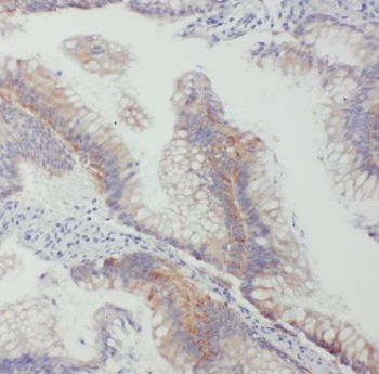 GJB2 Rabbit Polyclonal Antibody