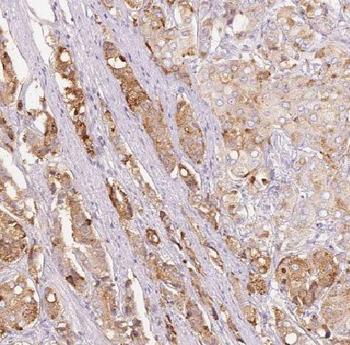 COPE Rabbit Polyclonal Antibody