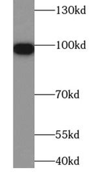 COPG1 Rabbit Polyclonal Antibody