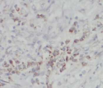 COPG1 Rabbit Polyclonal Antibody