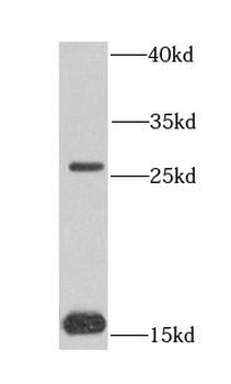 COQ7 Rabbit Polyclonal Antibody