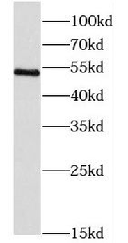 CORO2B Rabbit Polyclonal Antibody