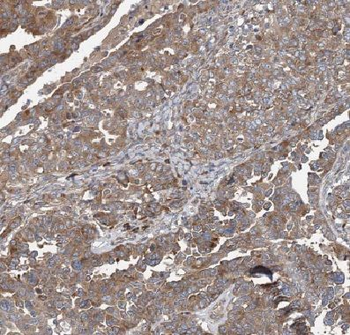 CORO2B Rabbit Polyclonal Antibody