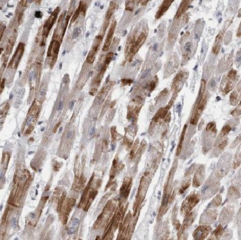 COX15 Rabbit Polyclonal Antibody