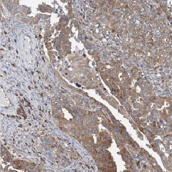 COX4I2 Rabbit Polyclonal Antibody