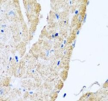 COX6B1 Rabbit Polyclonal Antibody
