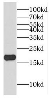 CPLX1 Rabbit Polyclonal Antibody