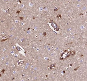 CPLX1 Rabbit Polyclonal Antibody