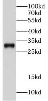 CPSF4 Rabbit Polyclonal Antibody