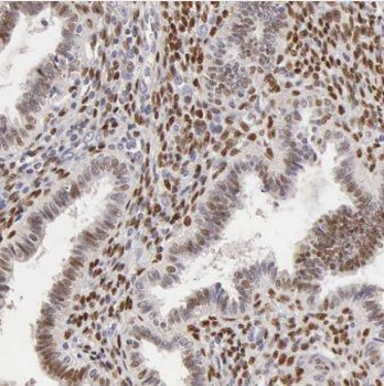 CPSF4 Rabbit Polyclonal Antibody