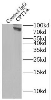 CPT1A Rabbit Polyclonal Antibody