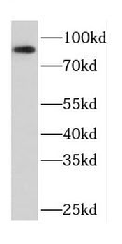 CPT1A Rabbit Polyclonal Antibody