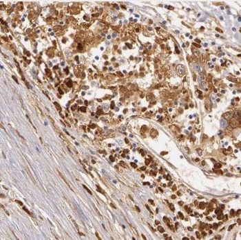 CPT1A Rabbit Polyclonal Antibody