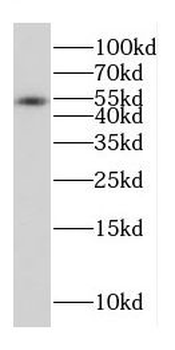 CPVL Rabbit Polyclonal Antibody