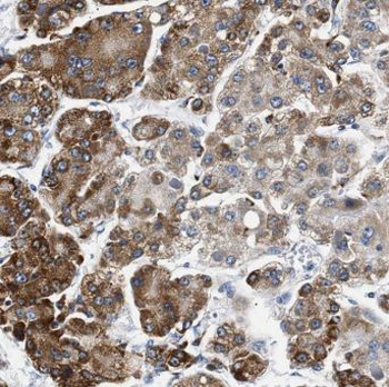 CPVL Rabbit Polyclonal Antibody
