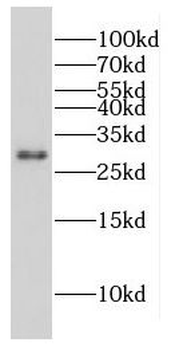 CPXCR1 Rabbit Polyclonal Antibody