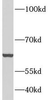CRAT Rabbit Polyclonal Antibody