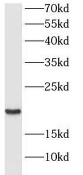 CRCP Antibody