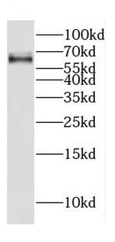 CREB3L2 Rabbit Polyclonal Antibody