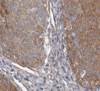 CRNN Rabbit Polyclonal Antibody
