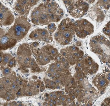 CROT Rabbit Polyclonal Antibody