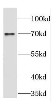 CRTAC1 Rabbit Polyclonal Antibody