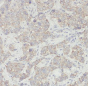 CSN3 Rabbit Polyclonal Antibody