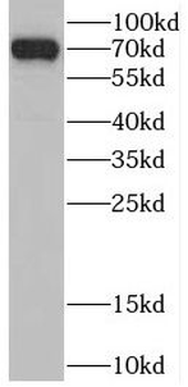 CSNK1A1L Rabbit Polyclonal Antibody