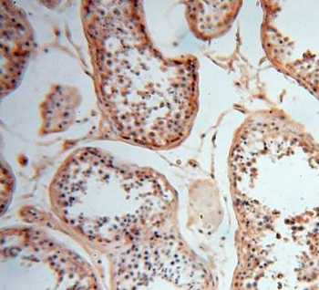 CSNK1A1L Rabbit Polyclonal Antibody